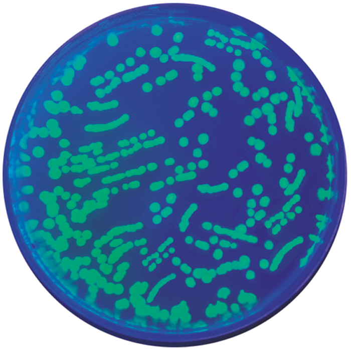 Transformation of E. coli with Green Fluorescent Protein (GFP)